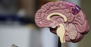 Parkinson – cientistas descobriram que sinais aparecem 20 anos antes