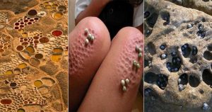 Tripofobia: o medo de buracos – essas fotos te incomodam?